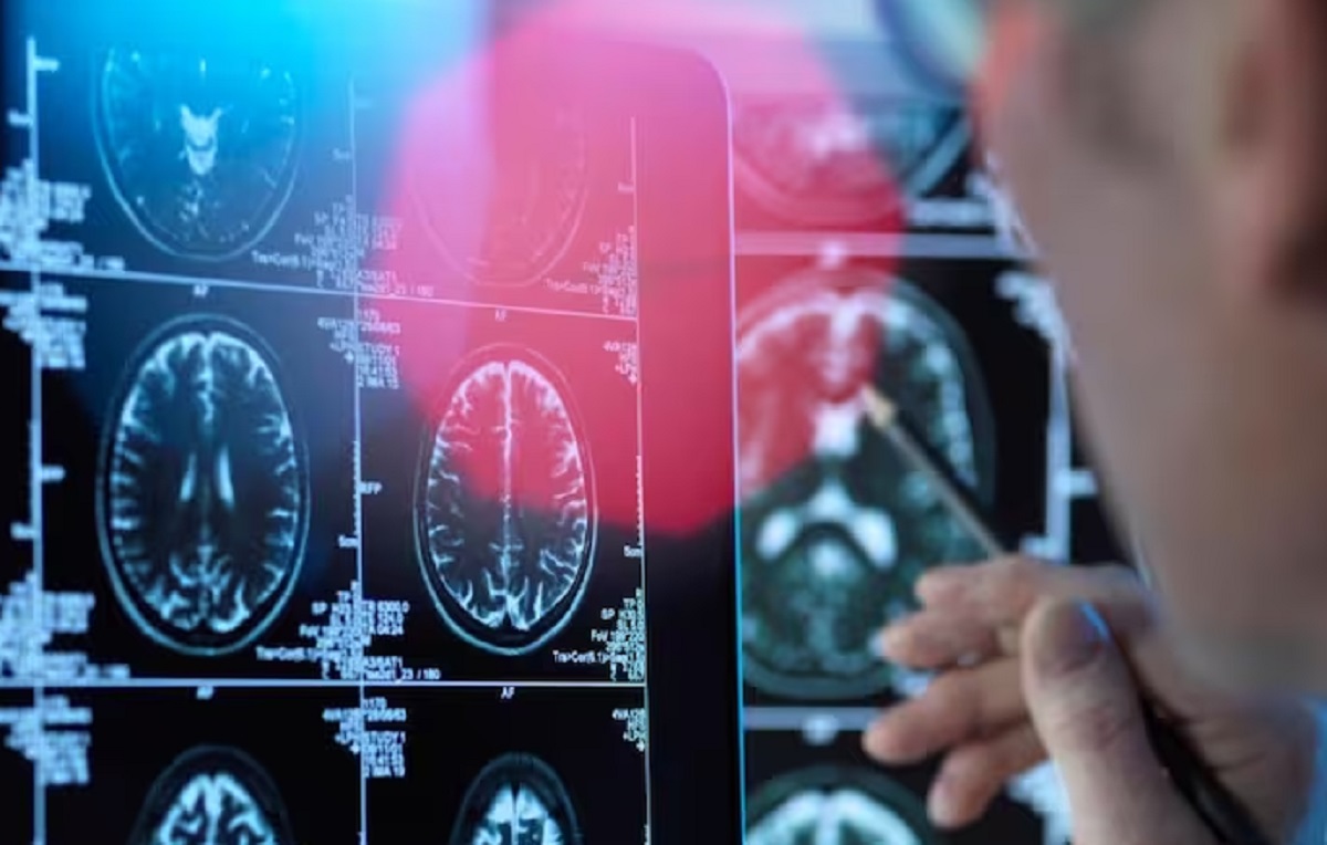 तरुण मुलाला अल्झायमर? संशोधक घेतायत आनुवंशिक कारणांचा शोध
