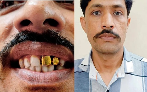 मुंबईत चोरी केल्यानंतर फरार झालेल्या आरोपीने सोन्याचे दात बसवले असल्याची माहिती पोलिसांना मिळाली होती. दरम्यान, त्याला विमा पॉलिसीचे आमिष दाखवून पोलिसांनी जाळ्यात अडकवलं.