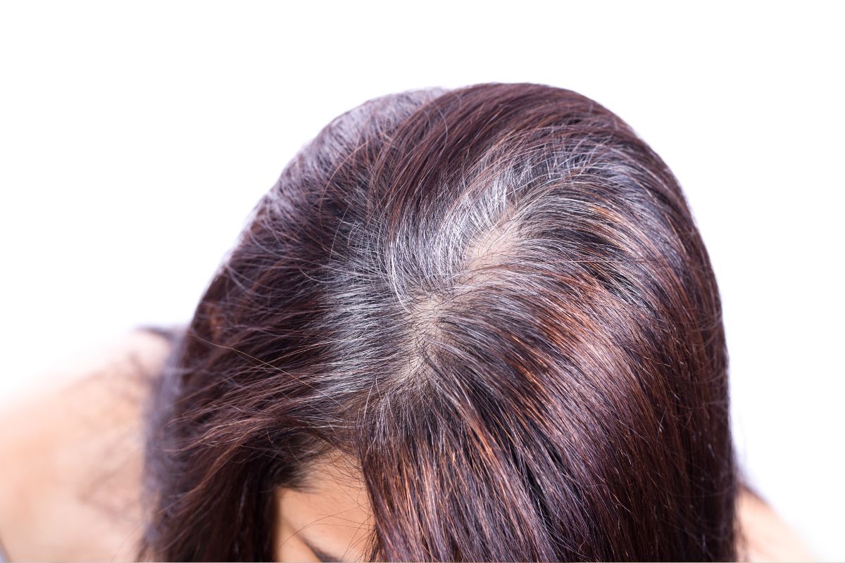 Health Tips : कमी वयात पांढरे होतायत केस? दुर्लक्ष टाळा, या गंभीर त्रासांचे असू शकते लक्षण