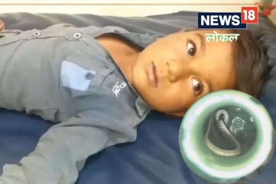 4 वर्षांच्या चिमुकल्याला चावला साप.