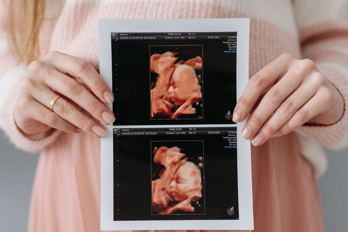 प्रतीकात्मक फोटो (सौजन्य - Canva)