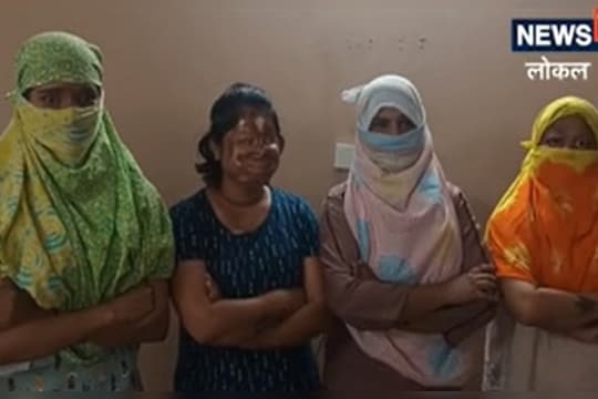 अॅसिड हल्ला करणारे मोकाट पण हल्ला झालेल्या मुलींची उन्हाळ्यातील मुलींच्या वेदना असह्य