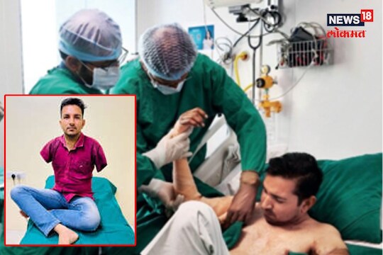 देशातील पहिली यशस्वी शस्त्रक्रिया 