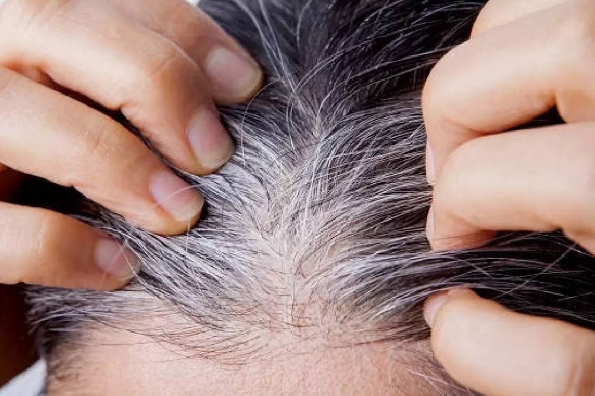 पांढरे केस होणार पुन्हा काळे