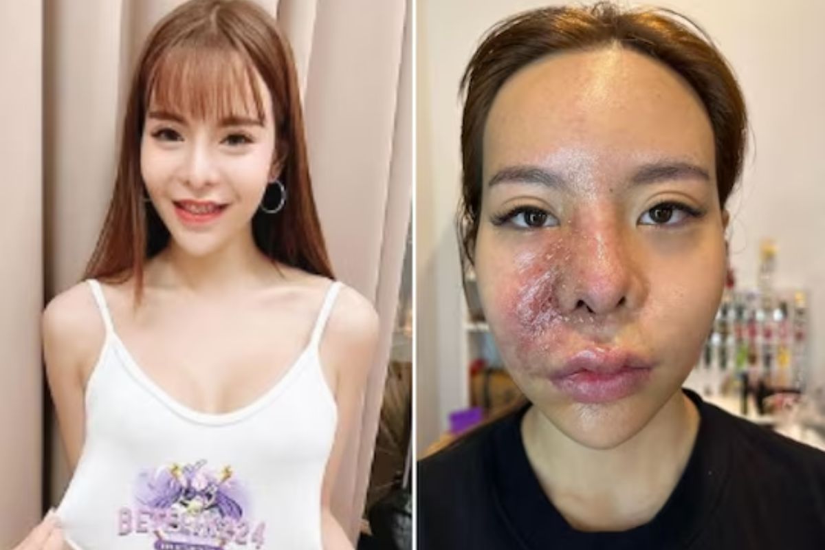 सर्जरीनंतर वाईट अवस्था