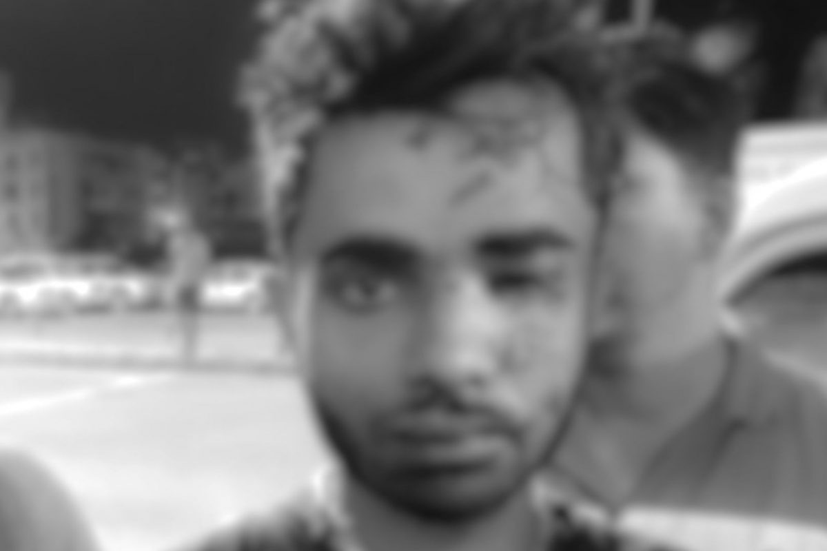 केरळमध्ये ट्रेन जाळून आरोपी जखमी अवस्थेत पोहोचला रत्नागिरीत; महाराष्ट्र ATSने केली अटक