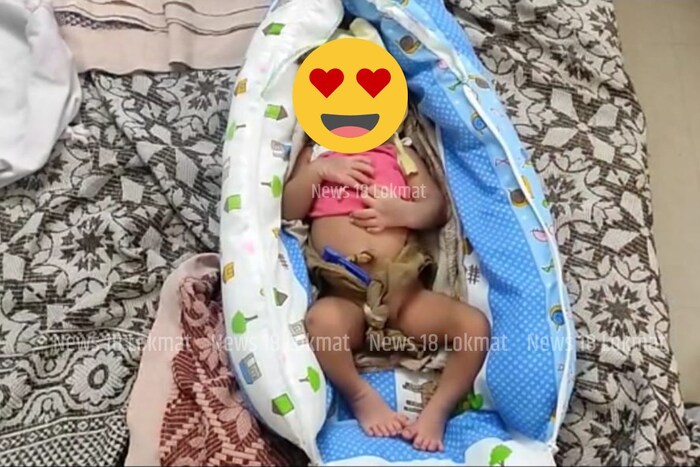 माणसाला सामान्यत: हातापायाची मिळून 20 बोटं असतात. काही जणांच्या हाताला किंवा पायाला एखाद बोट जास्त असतं. पण या बाळाला तब्बल 24 बोटं आहेत. त्याच्या दोन्ही हाताला आणि दोन्ही पायाला एक जास्तीचं बोट आहे.