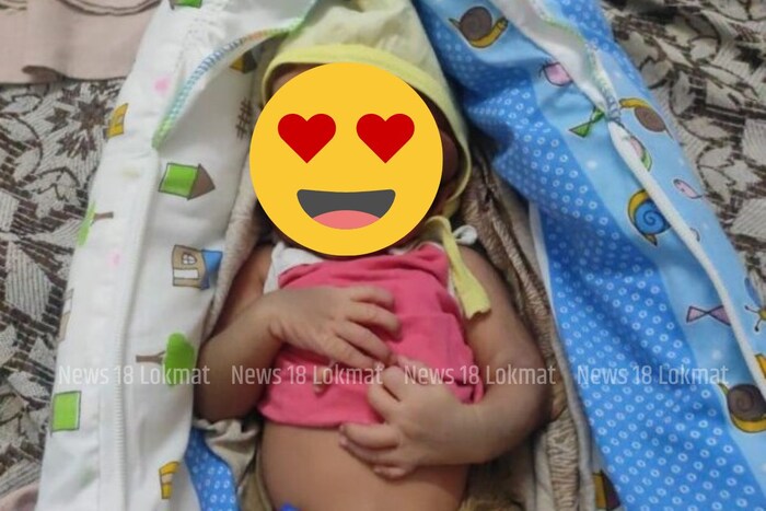 अलीकडच्या काळातील पहिलाच प्रकार असल्याचं डॉक्टर म्हणाले. बाळाची प्रकृती चांगली आहे आणि ते ठणठणीत आहे, असंही त्यांनी सांगितलं.