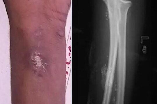 सुपरहिरो बनण्यासाठी मुलाचं धक्कादायक पाऊल