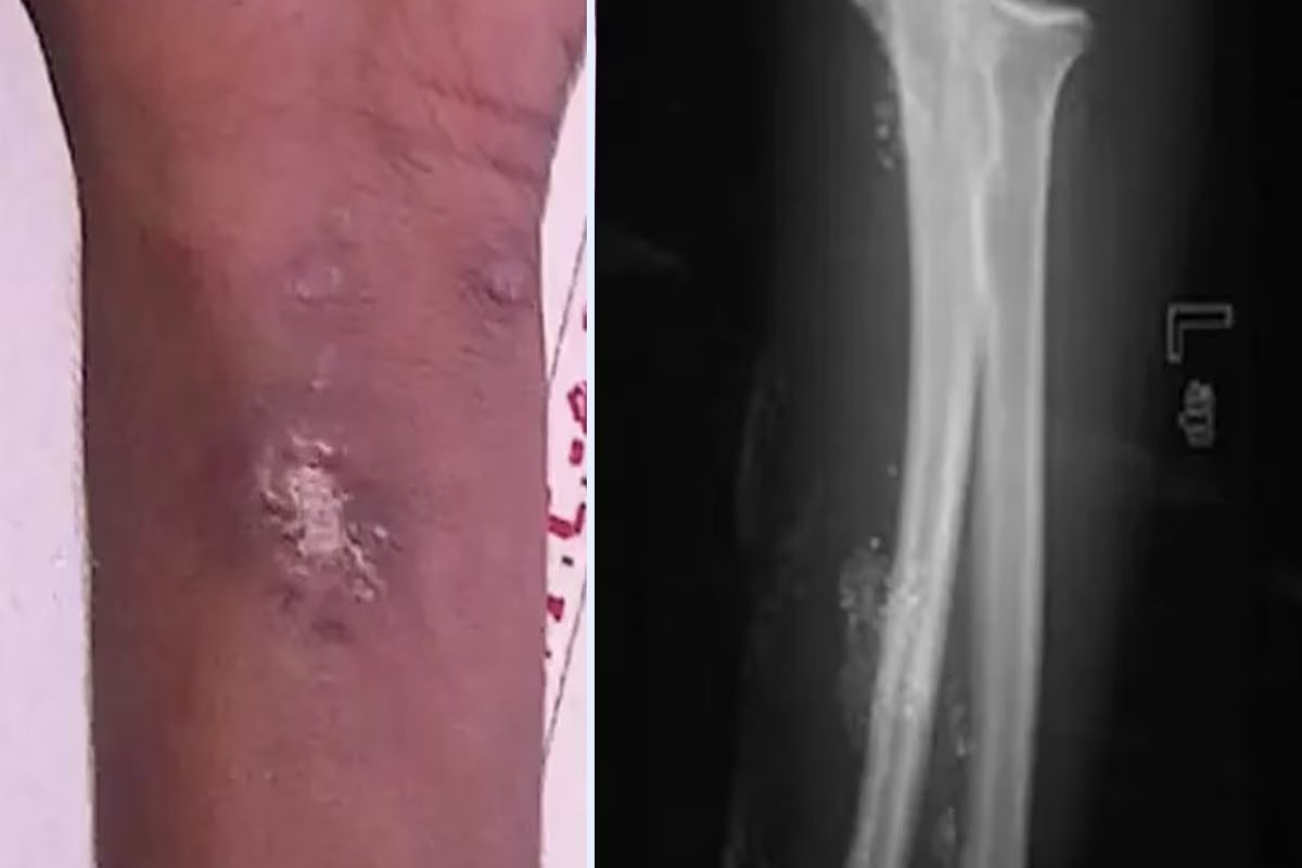 सुपरहिरो बनण्यासाठी मुलाचं धक्कादायक पाऊल