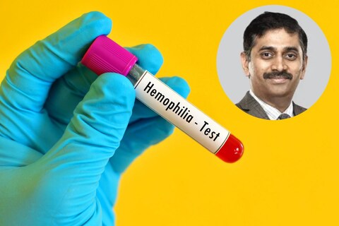 हिमोफिलिया आजाराची लक्षणं कोणती?
