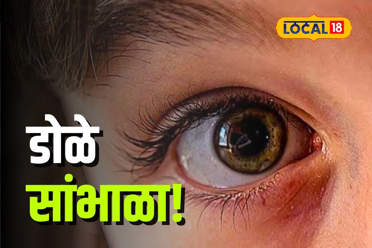 Dombivli News : तुमची मुलं मोबाईल सतत पाहतात? लगेच सवय तोडा, अन्यथा ‘या’ आजाराची होईल लागण, Video