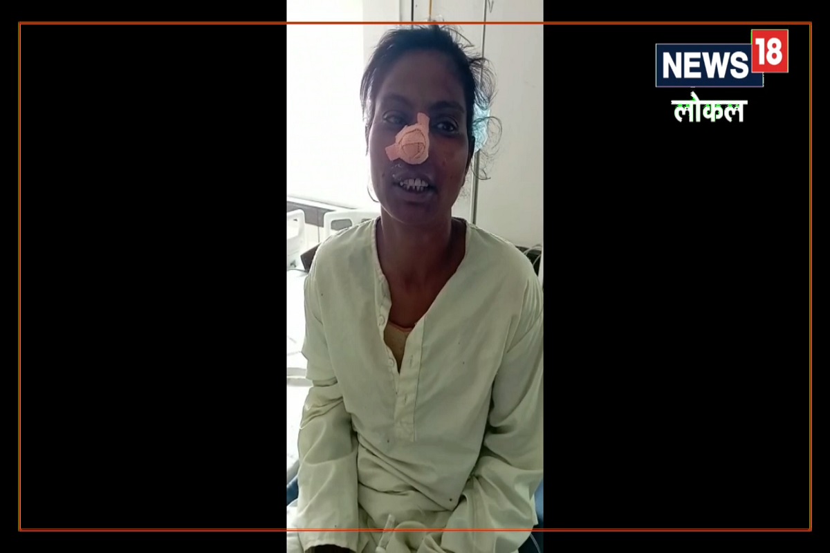 दगड आणखी काही काळ नाकात राहिला असता तर तिच्या जीवाला धोका होता, असं डॉक्टरांनी सांगितलं.