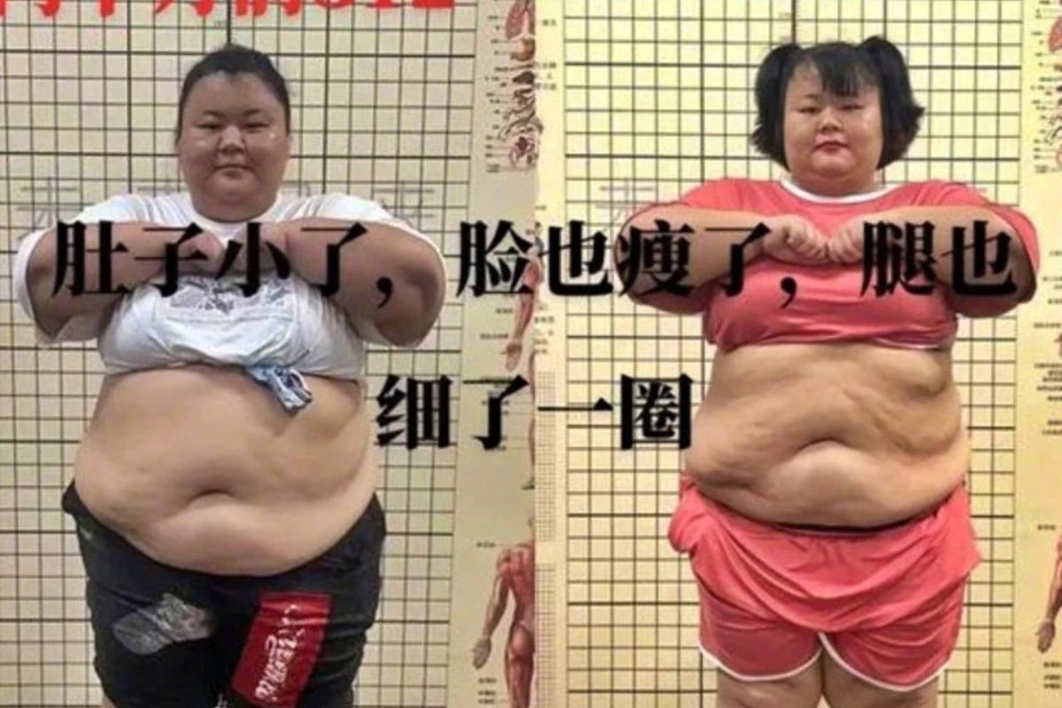 वजन कमी करण्याच्या तरुणीचा गेला जीव