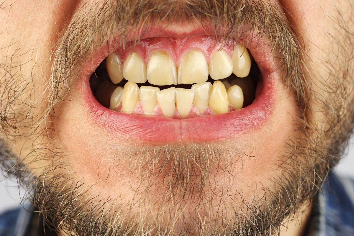 प्रतीकात्मक फोटो - Canva