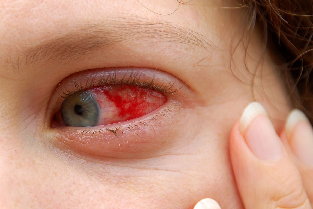 प्रतीकात्मक फोटो - Canva