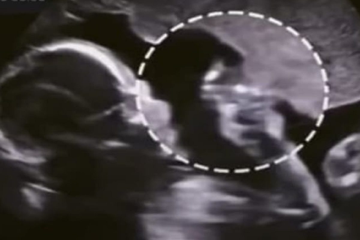 गर्भात बाळ (फोटो - इन्स्टाग्राम व्हिडीओ ग्रॅब)