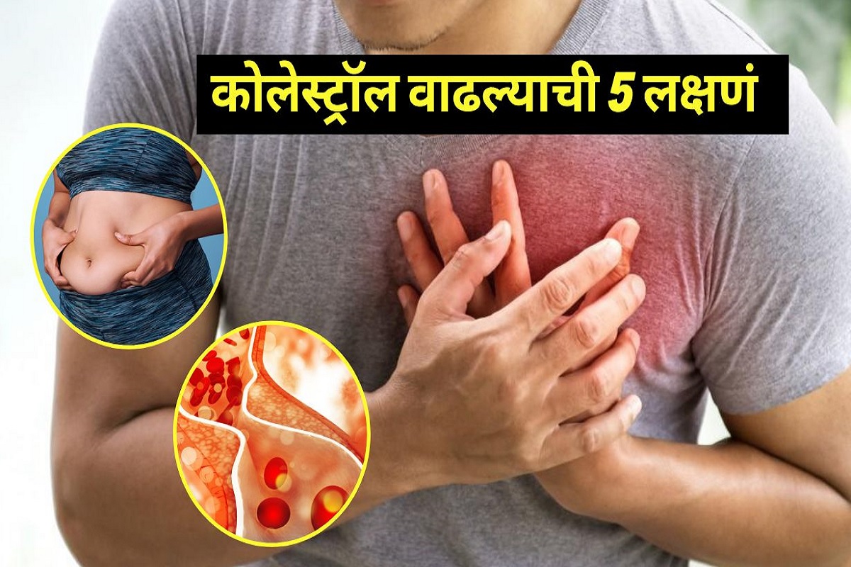 कोलेस्ट्रॉल वाढल्यावर शरीर देत हे 5 संकेत, वेळीच डॉक्टरांकडे जा अन्यथा