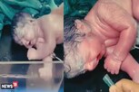 डॉक्टरांनी केला चमत्कार! मृत बाळाला 4 मिनिटांत पुन्हा जिवंत केलं; LIVE VIDEO