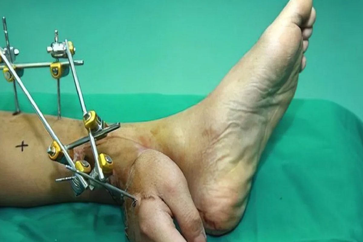 पायाला हात (फोटो - ट्विटर)