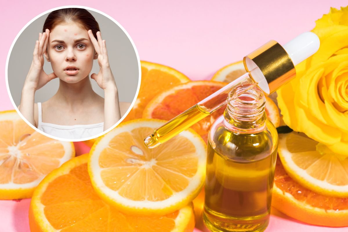 व्हिटॅमिन सी सीरम वापरण्यापूर्वी त्वचारोग तज्ज्ञांकडून महत्त्वाच्या गोष्टी जाणून घ्या.