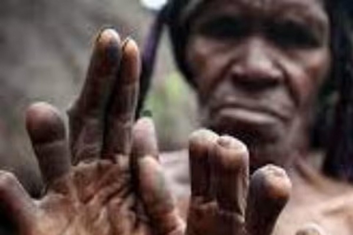 प्रिय व्यक्तीच्या निधनानंतर कापतात महिलांची बोटं