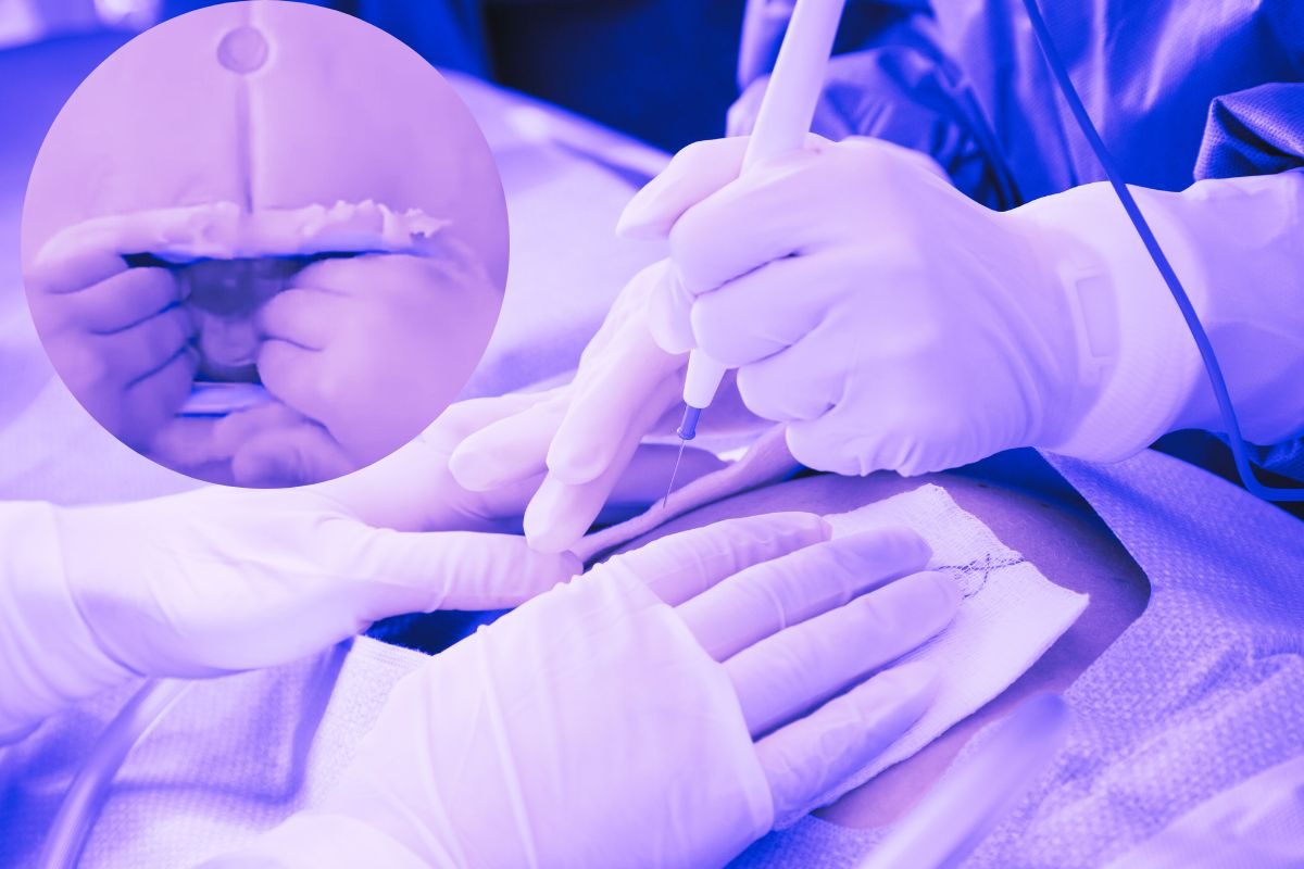 4 वर्षांच्या मुलाने केली सर्जरी