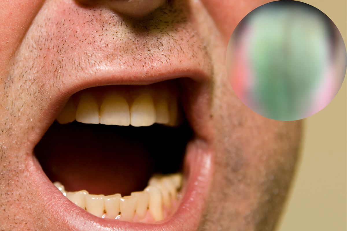 हिरव्या जिभेवर आले केस.