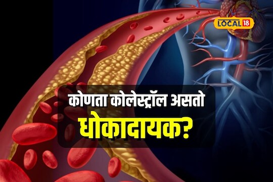 Health Tips: काय असतो गुड कोलेस्ट्रॉल आणि बॅड कोलेस्ट्रॉल? आजार होण्यामागे मूळ कारणे काय?