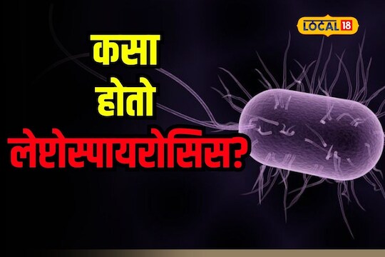 Mumbai News : मुंबईकरांमध्ये धडकी भरवणारा लेप्टोरियस कसा होतो? तो टाळण्यासाठी काय घ्याल खबरदारी?