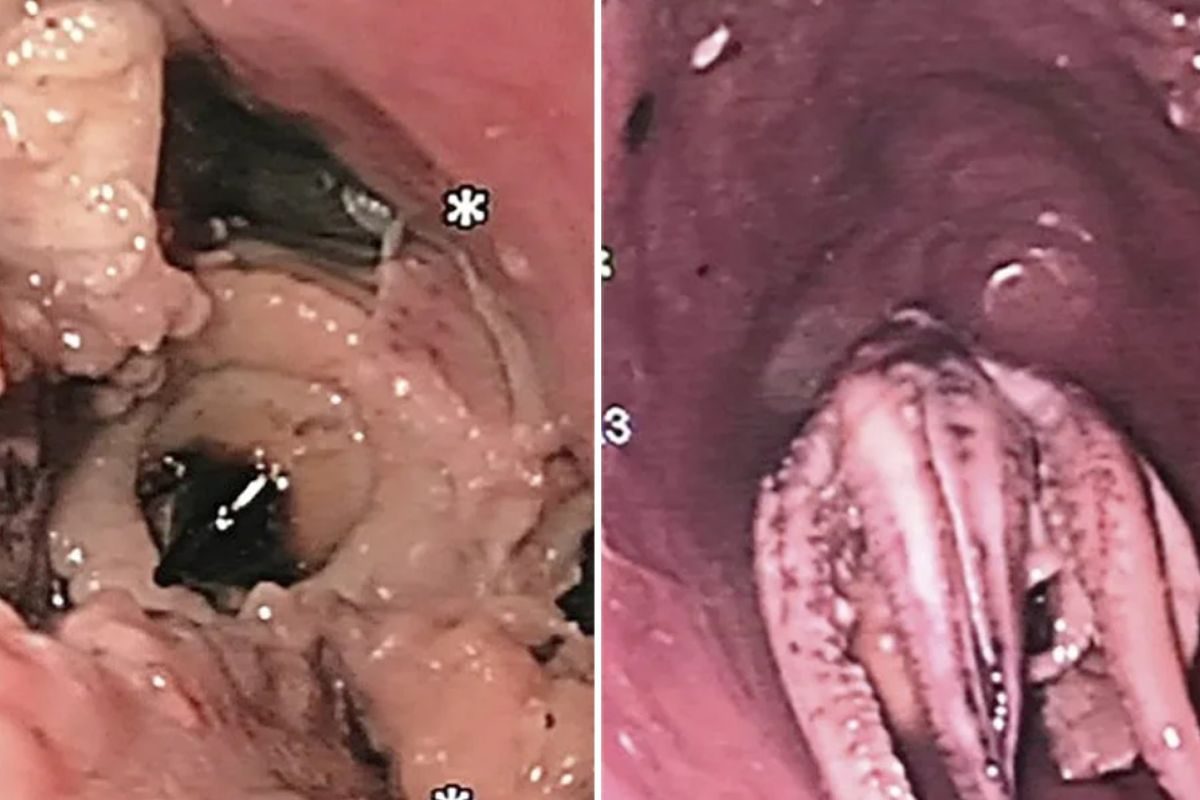 सोर्स : सोशल मीडिया