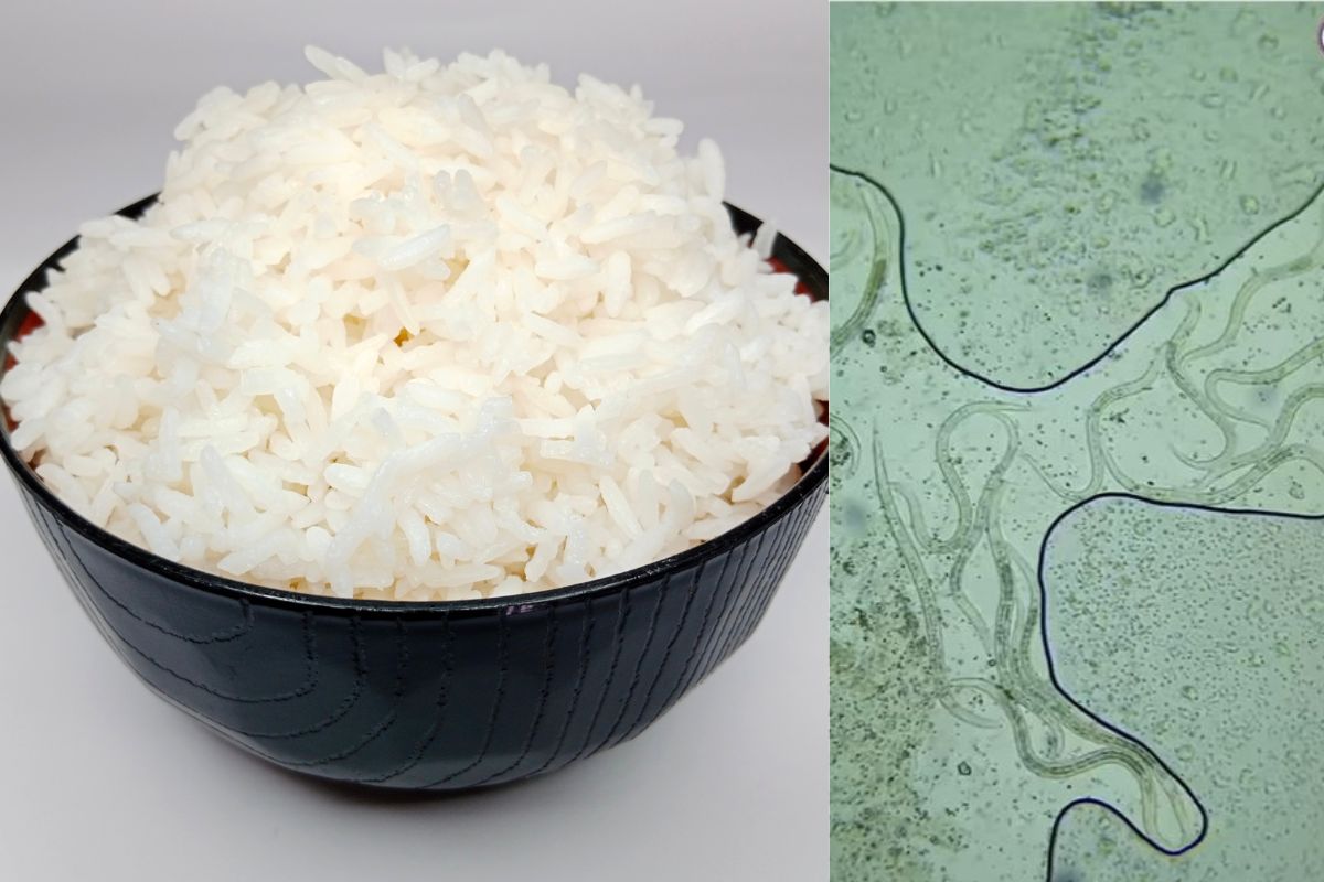 शिळ्या भातात दिसले बॅक्टेरिया