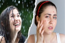 पावसाळ्यात चेहऱ्यावर पिंपल्स येतात? मग हे घरगुती उपाय करा आणि सौंदर्य टिकवा