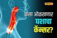 घशात सारखा कफ राहतोय? वेळीच सावध व्हा, लगेच डॅाक्टरांशी करा संपर्क