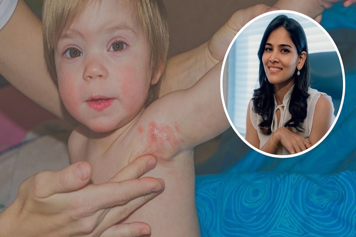 पावसाळ्यात लहान मुलांमध्ये उद्भवतायत त्वचेच्या समस्या? तज्ञांनी सांगितलेले 'हे' उपाय करून पाहा