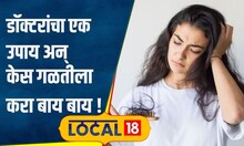 Hair Care: झाले सगळे शॅम्पू वापरून? आतातरी ऐका डॉक्टरांचं, साठीपर्यंत केस राहतील घनदाट | #local18