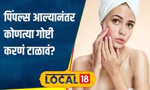 Skin care चेहऱ्यावर पिंपल्स आले असतील तर चुकूनही करू नका या तीन गोष्टी, नाहीतर होईल नुकसान #local18
