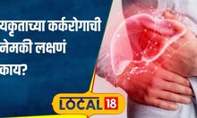 Cancer symptoms यकृताचा कर्करोग खूप भयंकर! आजाराची नेमकी लक्षणं काय? #local18