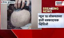 Buldhana Hirfall : काही सेकंदात केस गायब, धक्कादायक व्हिडीओ आला हाती