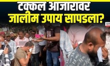 Buldhana News | टक्कल आजाराचा जालीम उपाय सापडला? कोल्हापुरात नेमकं काय सुरु ?