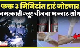 Intresting: China ने बनवलं तुटलेली हाडं चिटकवणारं सुपरग्लू, काय आहे यामागचं विज्ञान? N18G