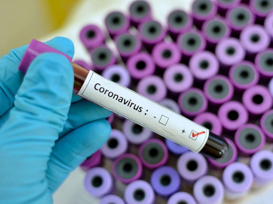 Coronavirus Updates India Tally Tops 14 With Over 47000 Cases in 24 Hrs Death Toll Crosses 33,000,