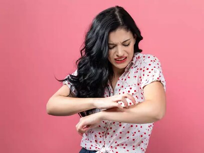 Health Tips: ಬೇಸಿಗೆಯಲ್ಲಿನ ತುರಿಕೆ ಸಮಸ್ಯೆಗೆ ಈ ಮನೆಮದ್ದುಗಳನ್ನು ಅನುಸರಿಸಿ