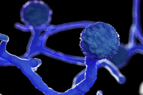 Explainer: ಕಪ್ಪು ಶಿಲೀಂಧ್ರ ಎಂದರೇನು ಮತ್ತು ಭಾರತ ಈ ವಿಚಾರದಲ್ಲಿ ದೊಡ್ಡ ಅಪಾಯದಲ್ಲಿರುವುದೇಕೆ..?