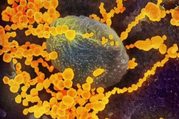 ಬ್ಲ್ಯಾಕ್ ಆಯ್ತು, ವೈಟ್ ಆಯ್ತು.. ಈಗ ಭಾರತದಲ್ಲಿ ಯೆಲ್ಲೋ ಫಂಗಸ್ ಪತ್ತೆ! ಕೀವು-ನೋವು ಭಾದಿಸಲಿದೆಯಂತೆ