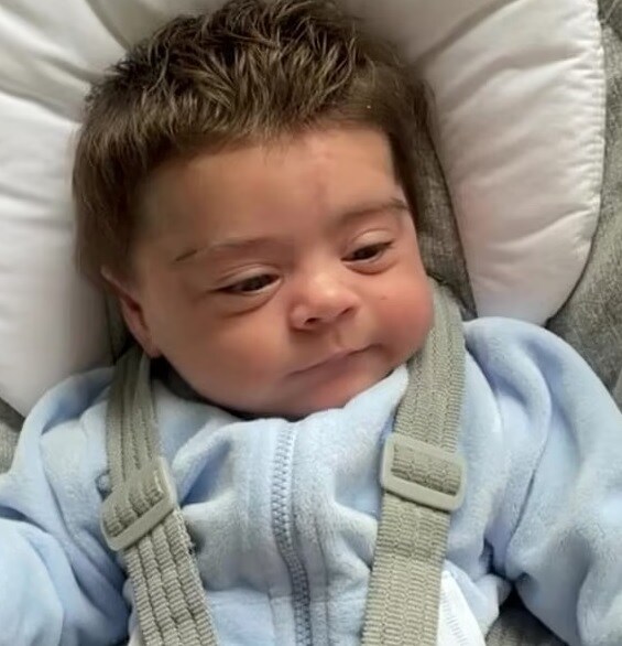 Premature Baby, Hair, Hyperinsulinism, Jaxon James Ayers, Social Media, Viral Photo,ಅಕಾಲಿಕ ಮಗು, ಕೂದಲು, ಹೈಪರ್ಇನ್ಸುಲಿನಿಸಮ್, ಜಾಕ್ಸನ್ ಜೇಮ್ಸ್ ಅಯರ್ಸ್, ಸಾಮಾಜಿಕ ಜಾಲತಾಣ, ವೈರಲ್ ಫೋಟೋ