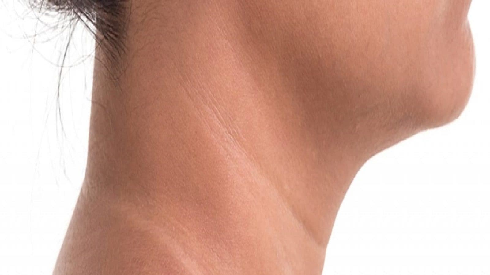 how-to-get-rid-of-dark-neck-in-20-minutes-video-dark-patches-on