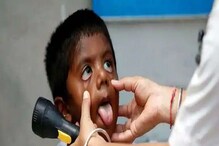 ಟೊಮೆಟೋ ತಿಂದ್ರೆ Tomato flu ಬರುತ್ತಾ? ಈ ಕುರಿತು ಏನ್ ಹೇಳ್ತಿದ್ದಾರೆ ತಜ್ಞರು ಟೊಮೆಟೋ ತಿಂದ್ರೆ Tomato flu ಬರುತ್ತಾ? ಈ ಕುರಿತು ಏನ್ ಹೇಳ್ತಿದ್ದಾರೆ ತಜ್ಞರು