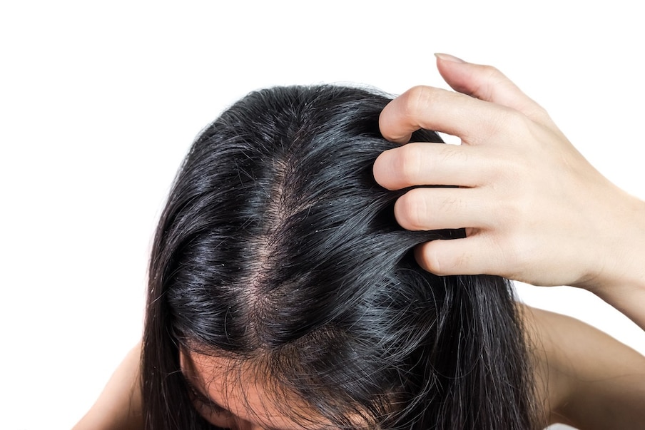 White Hair Problem Tips: ನಿಮ್ಮ ಕೂದಲು ಬೇಗ ಬೆಳ್ಳಗಾಗುತ್ತಿದೆಯೇ? ಹಾಗಿದ್ರೆ ಈ  ಸಲಹೆಗಳನ್ನು ಅನುಸರಿಸಿ