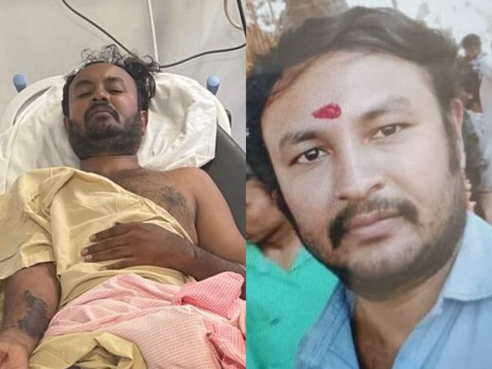 Bengaluru Acid Attack accused Nagesh hurt in police firing mrq | Acid Naga:  ಪೊಲೀಸರಿಂದ ತಪ್ಪಿಸಿಕೊಳ್ಳಲು ಯತ್ನ; ಆಸಿಡ್ ನಾಗನ ಕಾಲಿಗೆ ಗುಂಡೇಟು– News18 Kannada